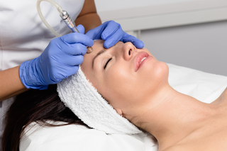 Microdermabrasion - S2G Medical Spa