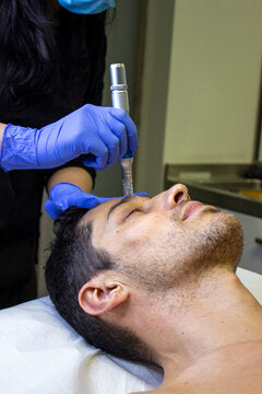 Microneedling - S2G Medical Spa