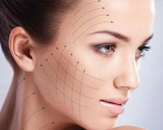 PDO Thread Lift - S2G Medical Spa
