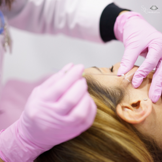 PDO Threat Lift Full Face Lift - S2G Medical Spa