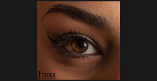 Fotona Brow Vector Lift - S2G Medical Spa