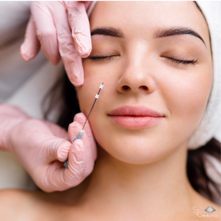 PDO Thread Nose Lift - S2G Medical Spa