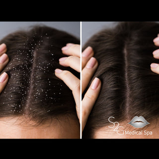 Scalp Treatment - S2G Medical Spa